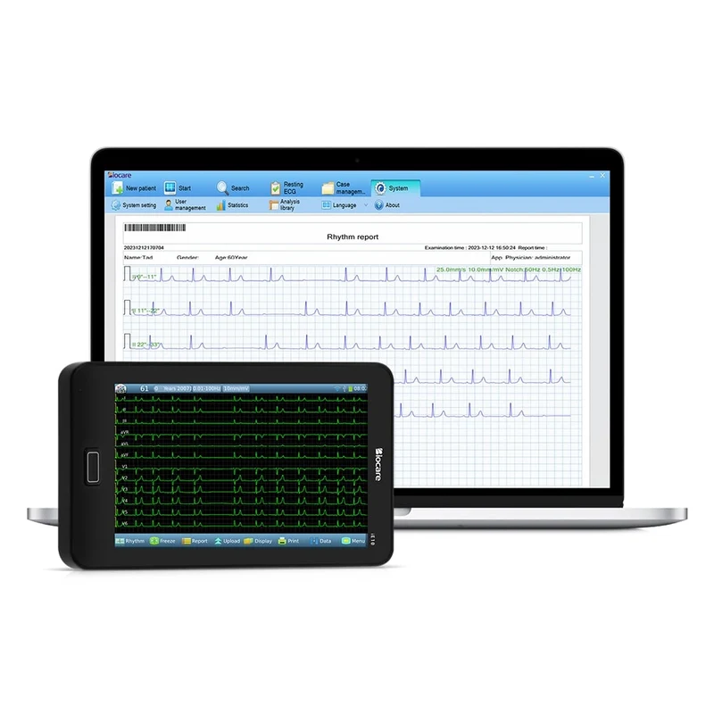 12-Kanal-EKG-Tablet
