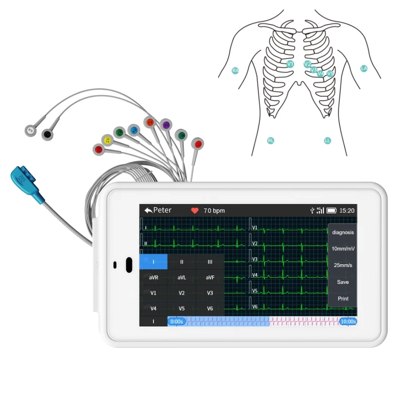Taschen-EKG-Gerät mit 12 Ableitungen