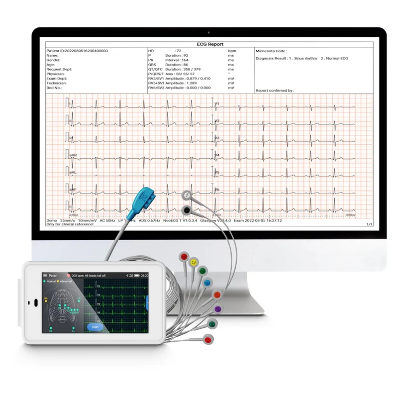 Taschen-EKG-Gerät mit 12 Ableitungen
